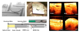 Electro-static dual axis scanning MEMS 미러 기반 OCT 내시경 시스템 개략도 및 3D rabbit trachea 이미징