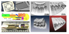 Electrothermal dual axis scanning MEMS 미러 기반 OCT 내시경 시스템 개략도 및 3D finger tip image