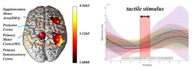 비우세손의 인공촉감 자극 시 뇌활성 및 그래프