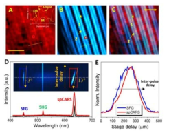 Coherent Raman Imaging of Live Muscle Sarcomeres