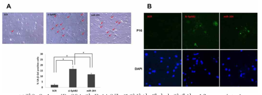 miR-204 가 Ephb2를 조절하여 해마 뉴런에서 p16 associated senescence 유도.