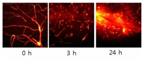 Collagenase 처리 시간에 따른 뇌혈관 손상 CARS 이미징