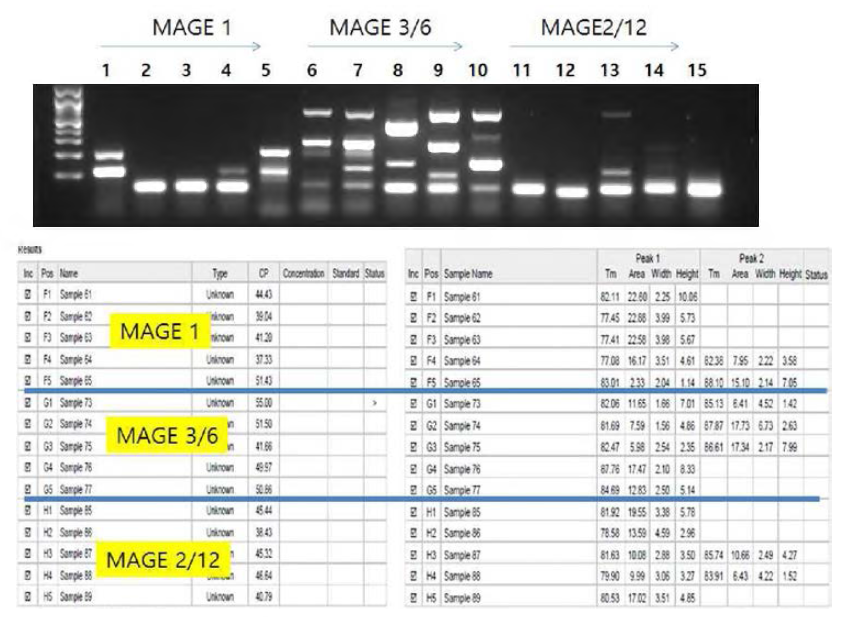 MAGE1 암세포는 MAGE3/6, 그리고 MAGE2/12를 검출하는 primer를 10개 대비 정상세포 107개 반복 실험 결과