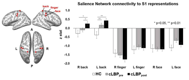 Salience network과 허리, 손가락, 얼굴의 감각을 담당하는 일차체성감각 피질 간의 연결성