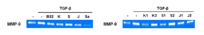 HBVP 세포에서 SCD-B-032의 TGF-β - ind니ced MMP-9 activity에 대한 억제 효능