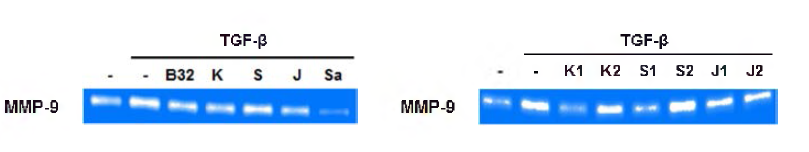 HBVP 세포에서 SCD-B-033의 TGF-β - ind니ced MMP-9 activity에 대한 억제 효능