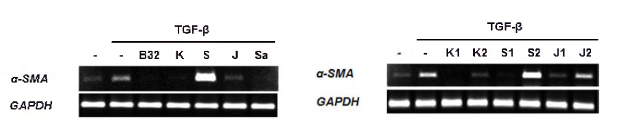 HBVP 세포에서 SCD-B-032의 TGF-β- ind 니 ced a-SMA expression 에 대한 영향