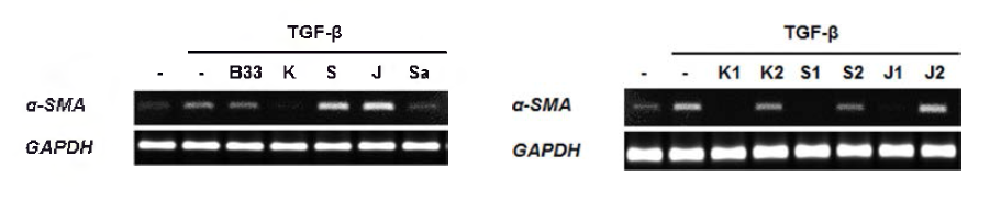 HBVP 세포에서 SCD-B-032의 TGF-β- ind 니 ced a-SMA expression 에 대한 영향