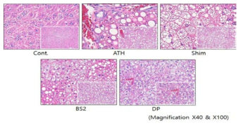 ATH 유도에서 담음약과 어혈약 투여 후 비알콜성 지방간 형성 개선