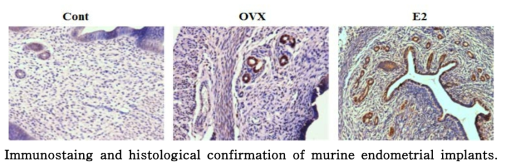 마우스 자궁내막의 면역 염색 및 조직염색