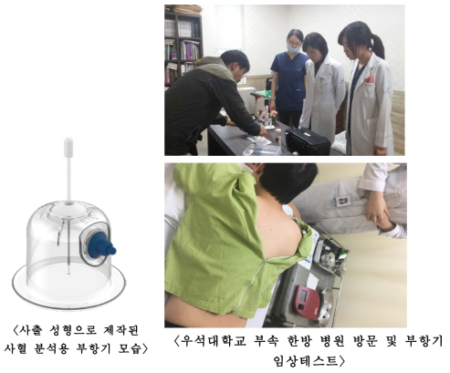 사혈 분석용 부항기와 임상테스트