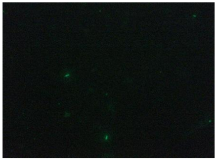 구성된 초점가변 형광 검경을 통해 관찰된 결핵균의 이미지