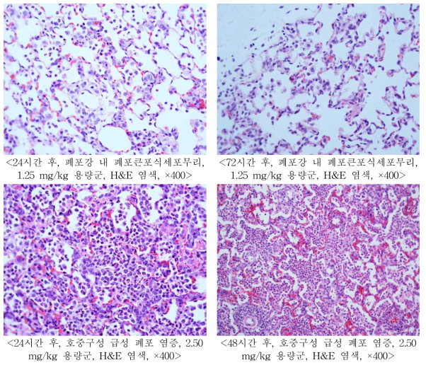LPS에 의한 급성 폐염증 유도 후 시간 경과에 따른 폐의 급성염증 관련 주요 소견(1차 시험)