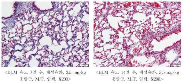 BLM에 의한 폐섬유화 유도 확인(2차 시험)