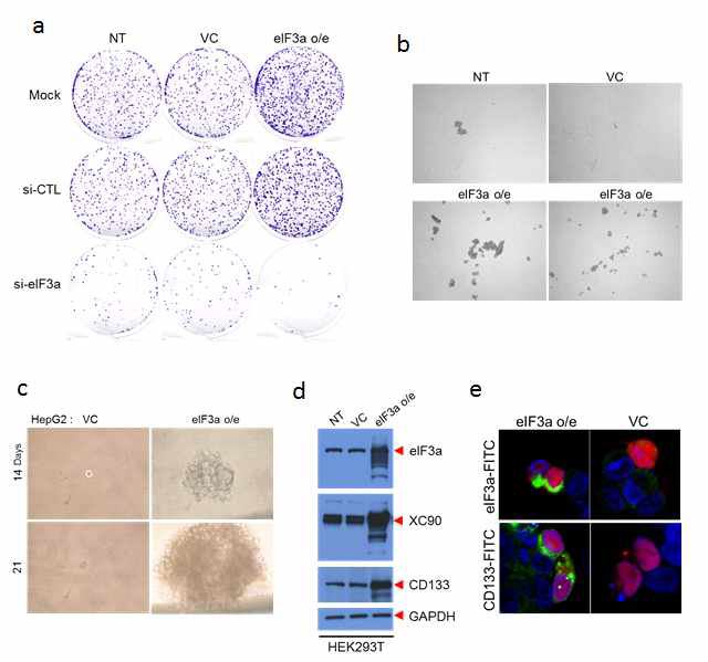 간암마커오토항체 특이반응 항원 XC90의 간암발병 관련성 연구