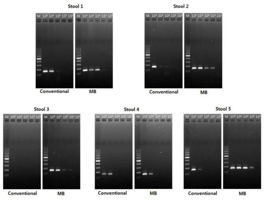 Spiking 검체를 대상으로 Conventional PCR과 MB PCR 비교