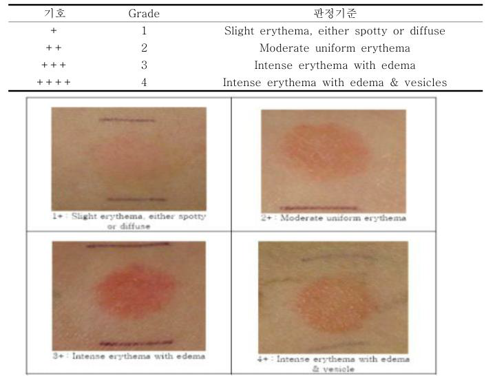 피부자극육안평가법