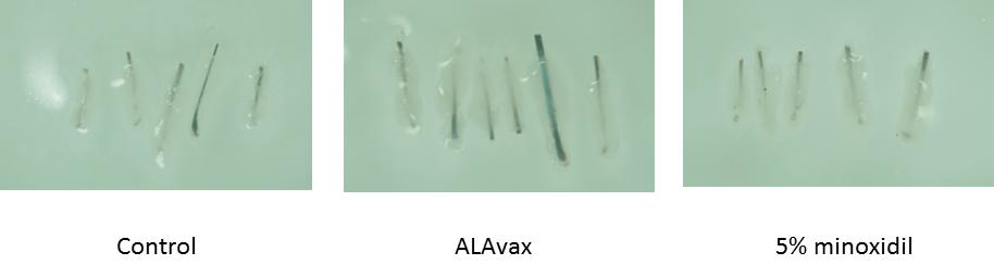 Growth of eyebrow by ALAVAX