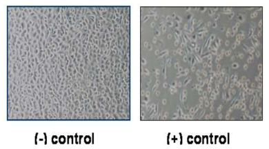 Evaluation of Cytotoxicity test by eluents dilution method