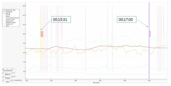 BCG의 HRV분석을 통한 졸음검출 알고리즘 기초실험 결과데이터의 예