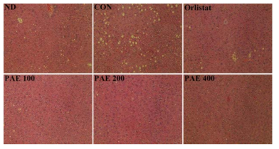 Effect of PAE for 6 weeks on hepatic morphology in C57BL/6J mice fed high-fat diet.