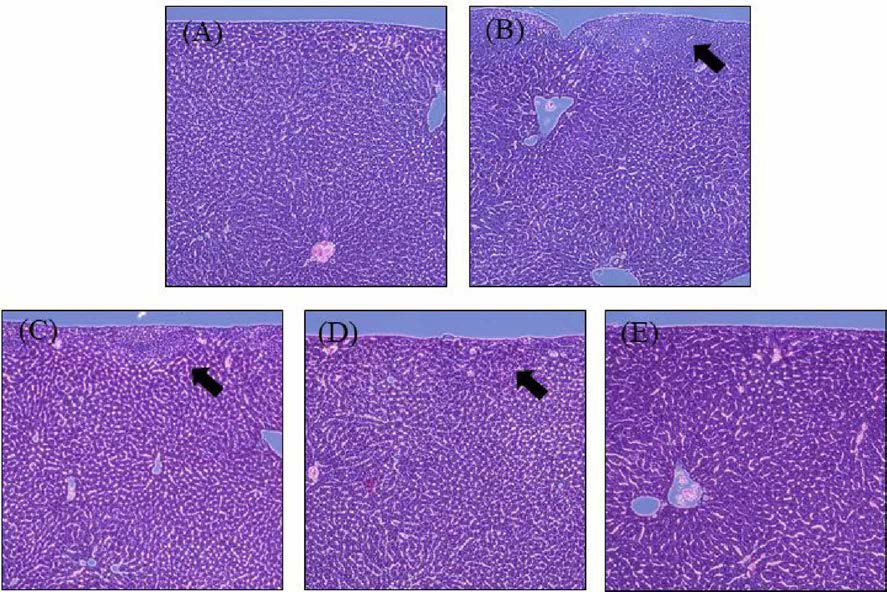 H&E staining (A)Normal: normal mice. (B)Damage: t-BHP(2 mmol/kg) treated mice, (C )Low concentration: t-BHPand low concentration of sample (25 mg /kg ) treated mice, (D )High concentration: t-BHP and high concentration of sample (50 mg /kg ) treated mice, (E)Silymarin: t-BHPand Silym arin (50 mg/kg)treated mice.