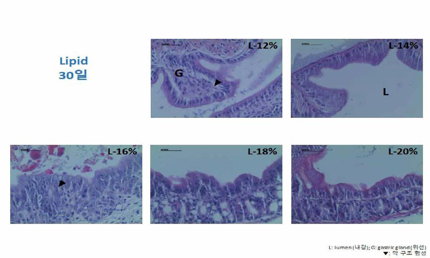 과립형 미립자 사료내 지질 함량에 따른 부화후 3원령 넘치 자치어의 위 조직과 위선조직 관찰