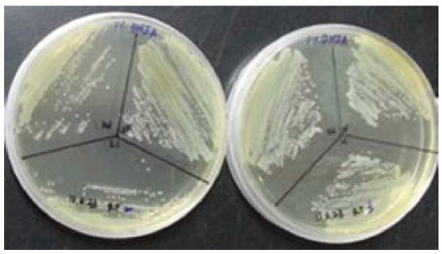 Colony of Vibrio sp. from diseased rainbow trout