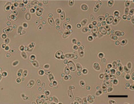 Morphology of yeast (Candida sp. ) from distended stomach.