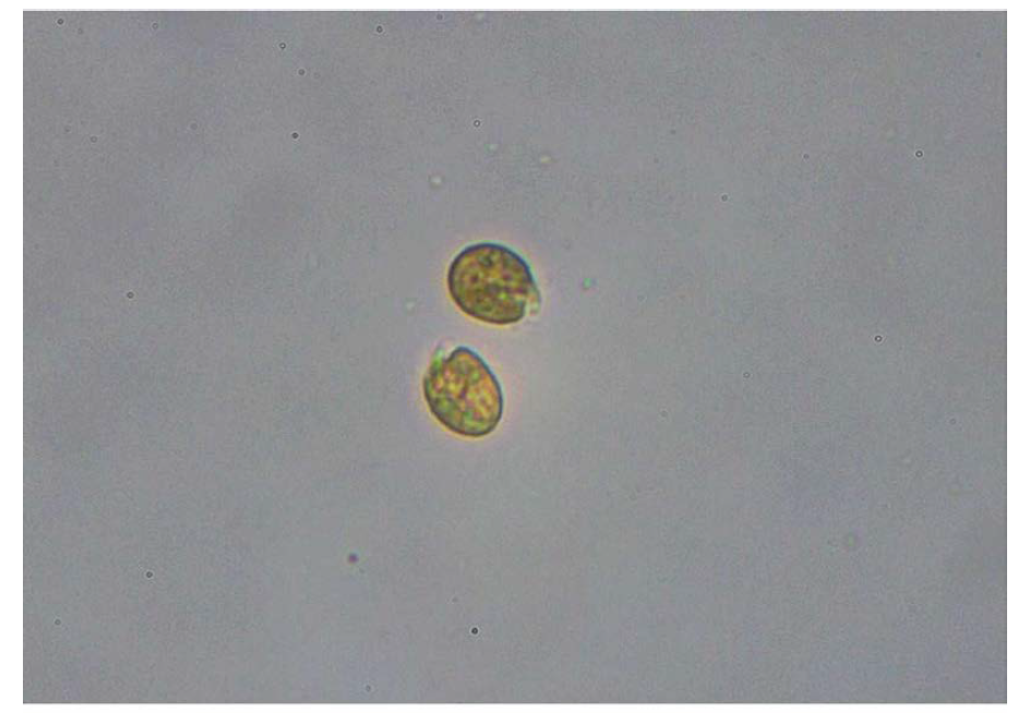 Amphidinium carterae JHW1510 현미경 관찰