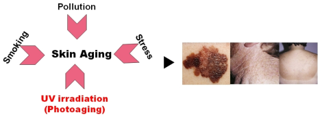 외인성 피부노화를 일으키는 유해 인자