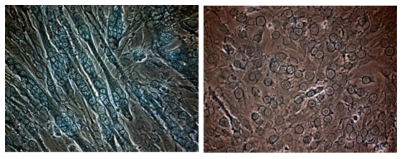 Myotube 형성 관찰. C2C12 세포 분화 후 myotube 형성정도를 Giemsa 염색법을 통해 확인하고 fusion index를 진행하여 정량화