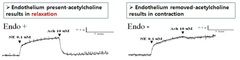 Organ-bath 내 적출 혈관의 혈관 내피 존재 시와 내피세포 제거 시 Acetylcholine에 대한 반응성 차이