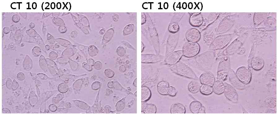 클라미디아가 유발하는 세포병변효과 (CPE), McCoy cell