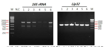 PCR로 16S rRNA (왼쪽), LipL32 (오른쪽) 유전자를 증폭한 결과