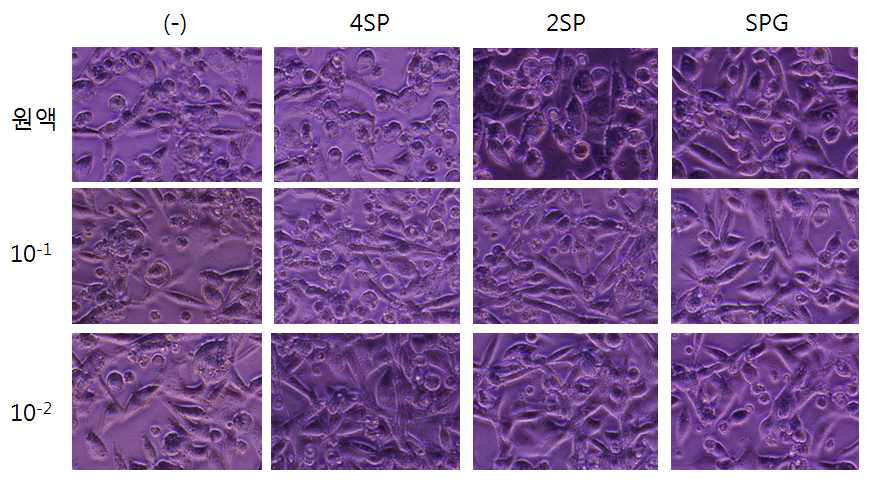 3 month보존 Deepfreeze stock _Chlamydia 배 양 결과 감염 48시간대 봉입체 수