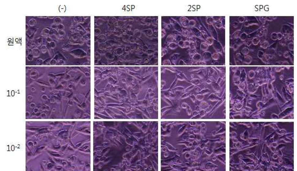 3 month보존 Deepfreeze stock _Chlamydia 배 양 결과 감염 46시간대 봉입체 수