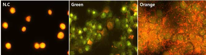 오리엔티아를 L929 세포에 감염시켜 acridin orange로 염색한 결과.