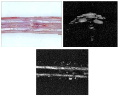 mouse 꼬리의 피부를 제거한 이후의 힘줄 조직의 사진(좌)과 피부의 제거없이 얻은 꼬리 힘줄의 광음향 단층 영상(중), 꼬리의 힘줄의 3차원 광음향 영상(우)