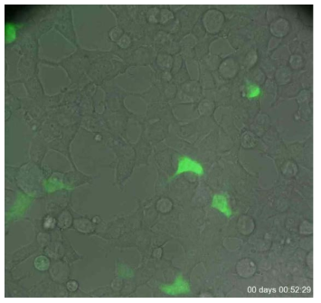 위상차 현미경과 형광 현미경을 결합한 세포와 발현한 형광단백질 이미지