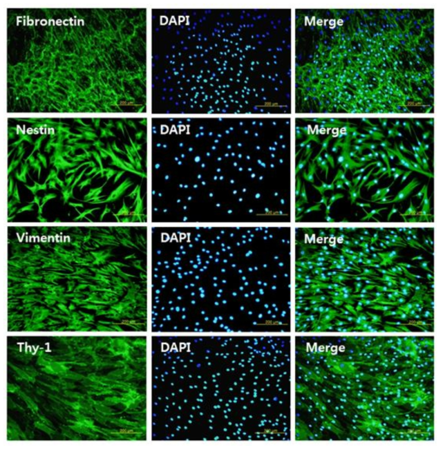 미분화 골수유래 중간엽줄기세포의 면역 형광염색법 실험결과
