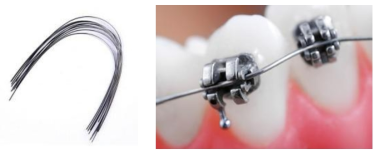 치과교정용선재