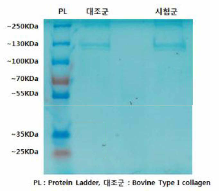 전기영동시킨 SDS-PAGE gel
