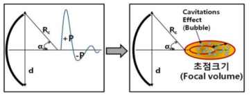 체외충격파 발생부 구조에 따른 초점분포