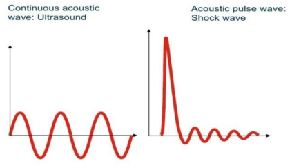 초음파 파형(왼) 및 충격파 파형