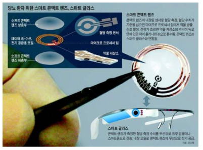 당뇨병 환자를 위한 스마트 콘택트 렌즈