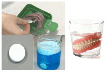 화학적인 방법에 의한 의치세정
