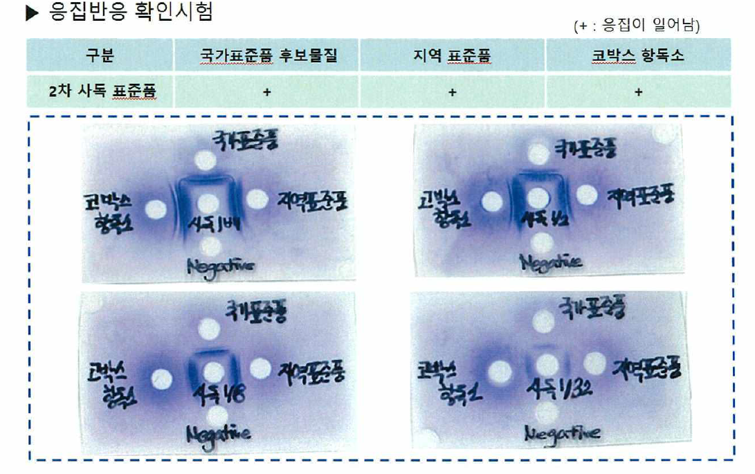 항독소 응집반응시험