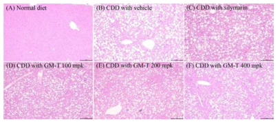 콜린결핍식이를 섭취한 마우스의 간 조직 사진