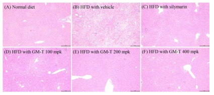 고지방식이를 섭취한 마우스의 간 조직 사진